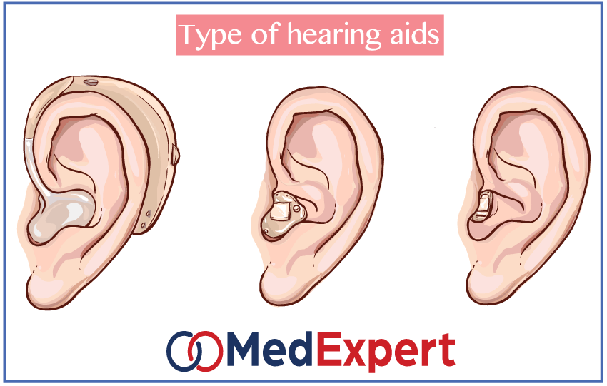 three types of hearing aids