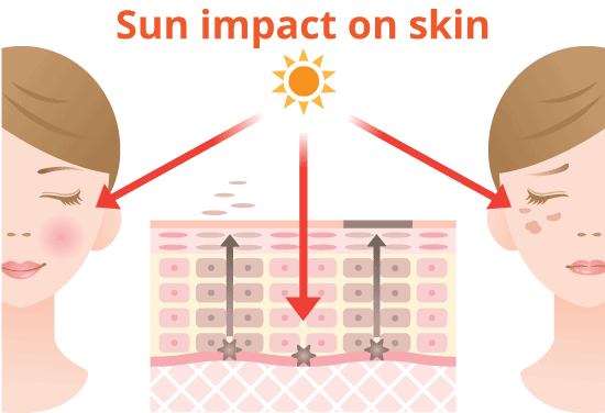 pigmentation, melasma treatment and diagnosis