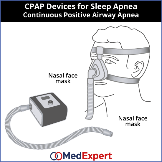 snoring therapy, CPAP therapy