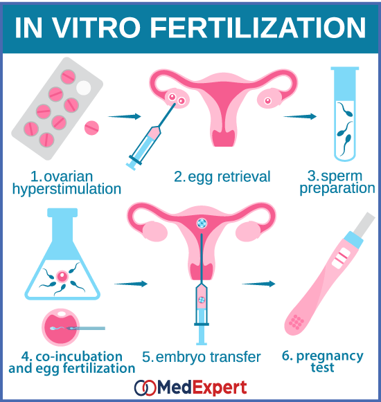 oligospermia; low sperm count; Oligospermia treatment; IVF