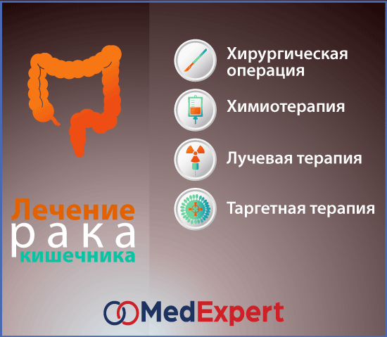 рак толстой кишки; Симптомы рака толстой кишки; Лечение рака толстой кишки