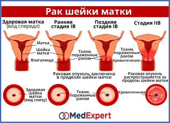 Вид Матки Фото