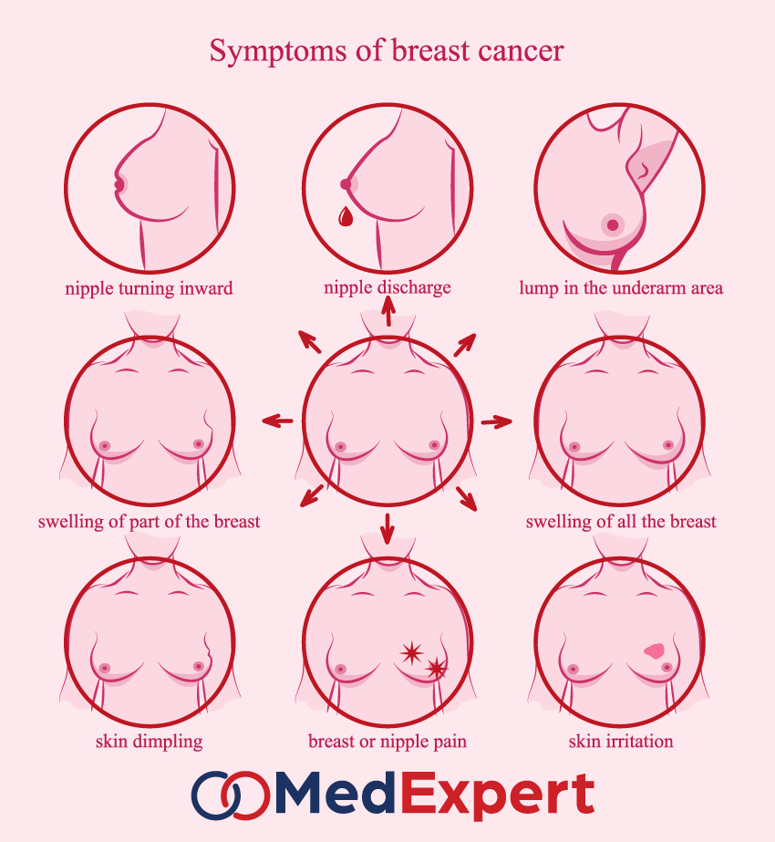 Nipple and Breast Problems