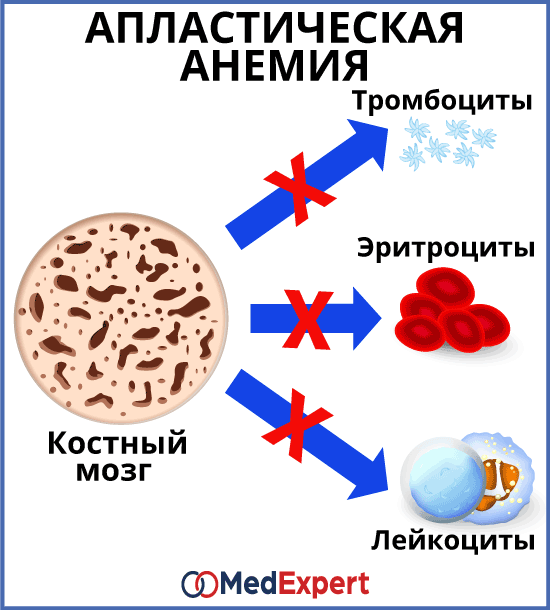 Что значит угнетение функции костного мозга. Смотреть фото Что значит угнетение функции костного мозга. Смотреть картинку Что значит угнетение функции костного мозга. Картинка про Что значит угнетение функции костного мозга. Фото Что значит угнетение функции костного мозга