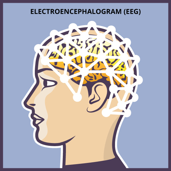 sleep disorder diagnosis eeg