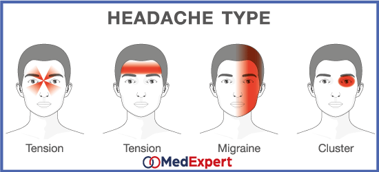 headache types, treatment and diagnosis