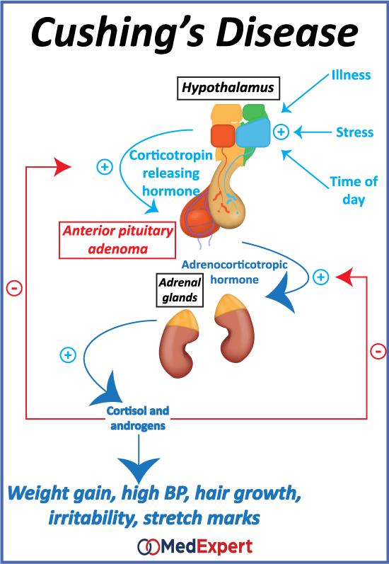 cushing's disease treatment and symptoms