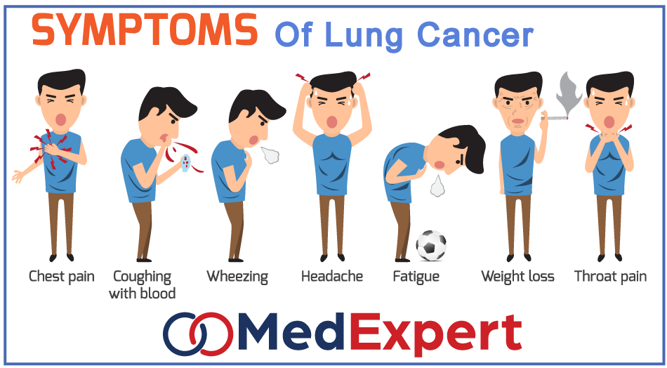 Lung Cancer Diagnosis Treatment And Prevention Med Expert