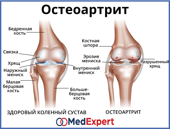 Фото Коленного Сустава Человека С Описанием