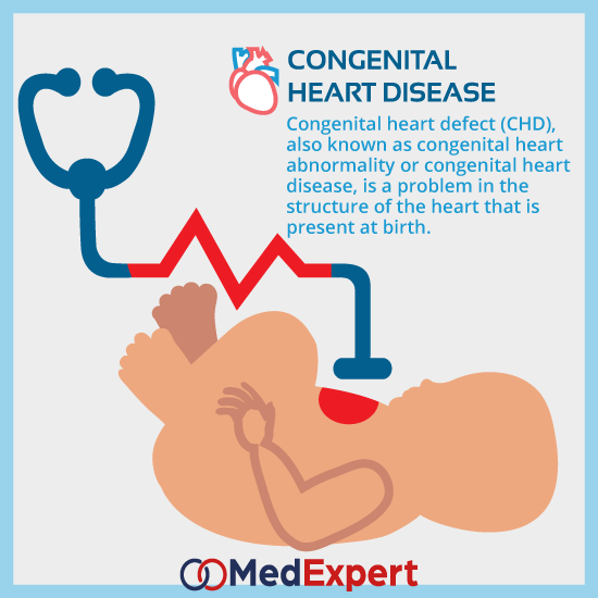 congenital heart disease treatment and diagnosis