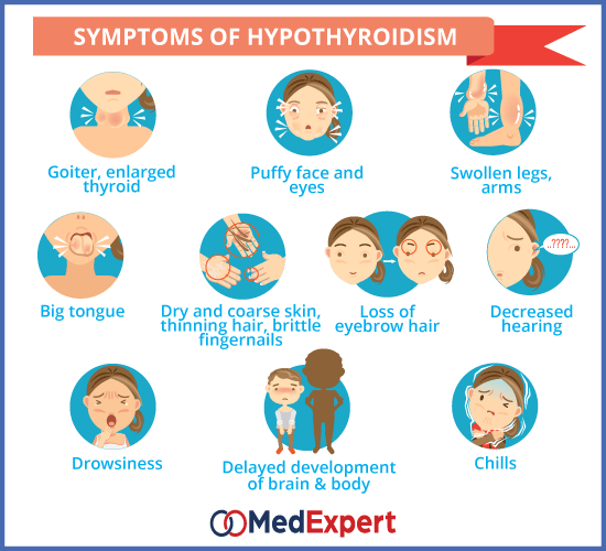 hypothyroidism symptoms and diagnosis