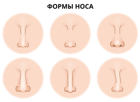 Формы Носа И Их Названия Фото