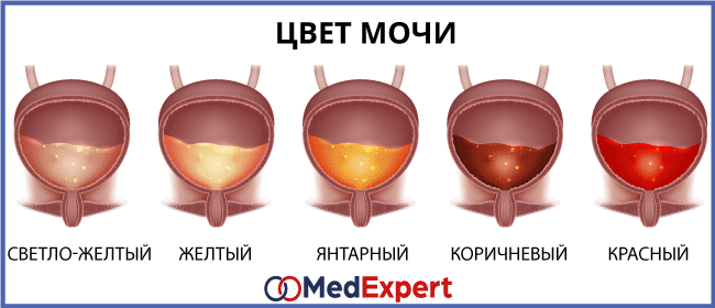 Кровь в моче у женщин: причины и возможные заболевания